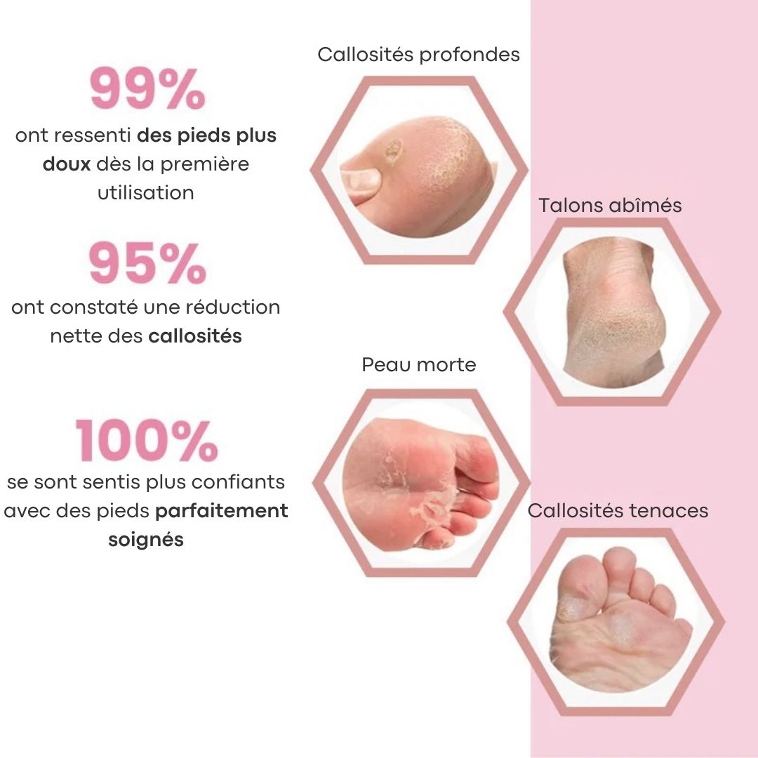 Râpe exfoliant pieds – Des talons doux sans effort