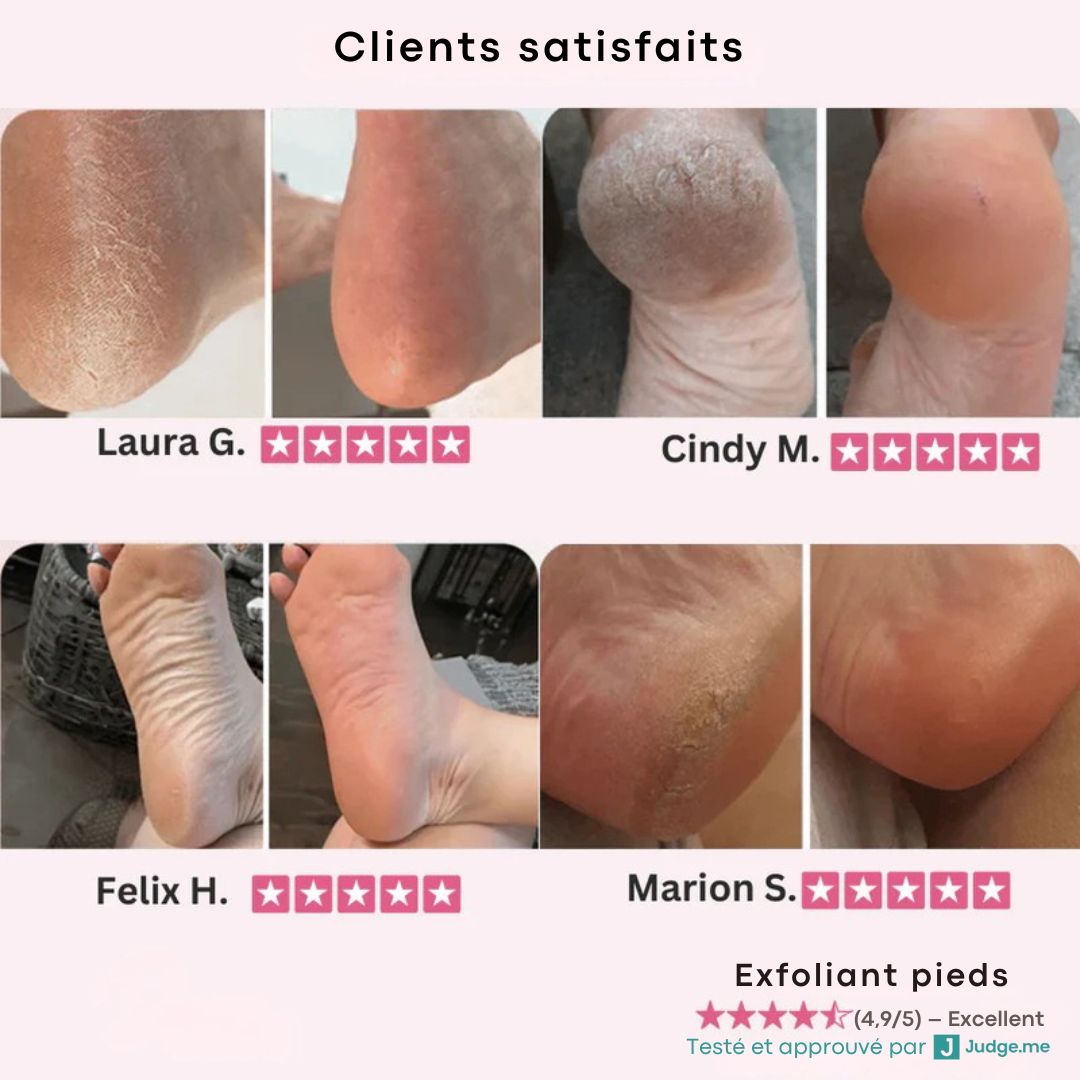 Râpe exfoliant pieds – Des talons doux sans effort