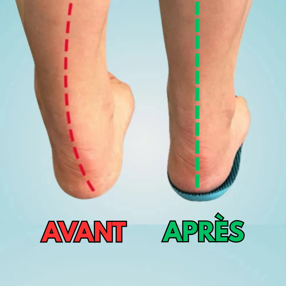 Semelles Orthopédiques Confort+ – Soulagez vos pieds et marchez sans douleur