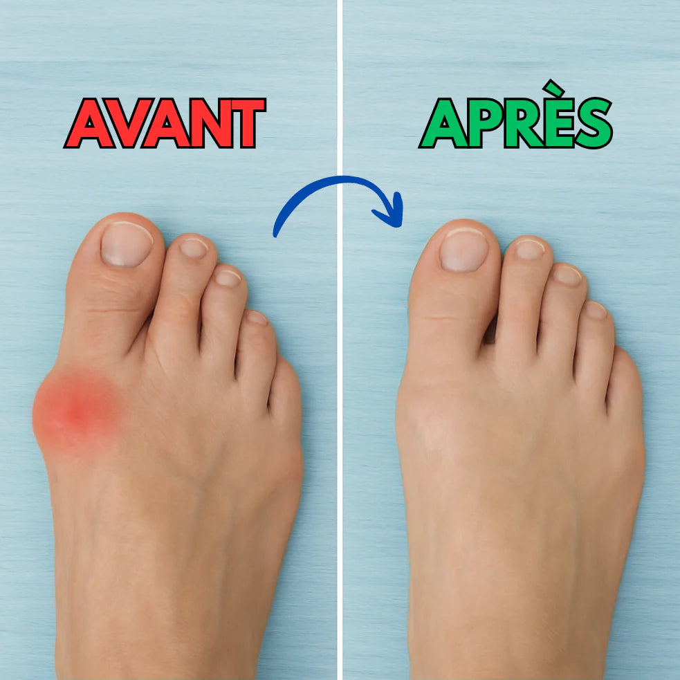 Semelles Orthopédiques Confort+ – Soulagez vos pieds et marchez sans douleur