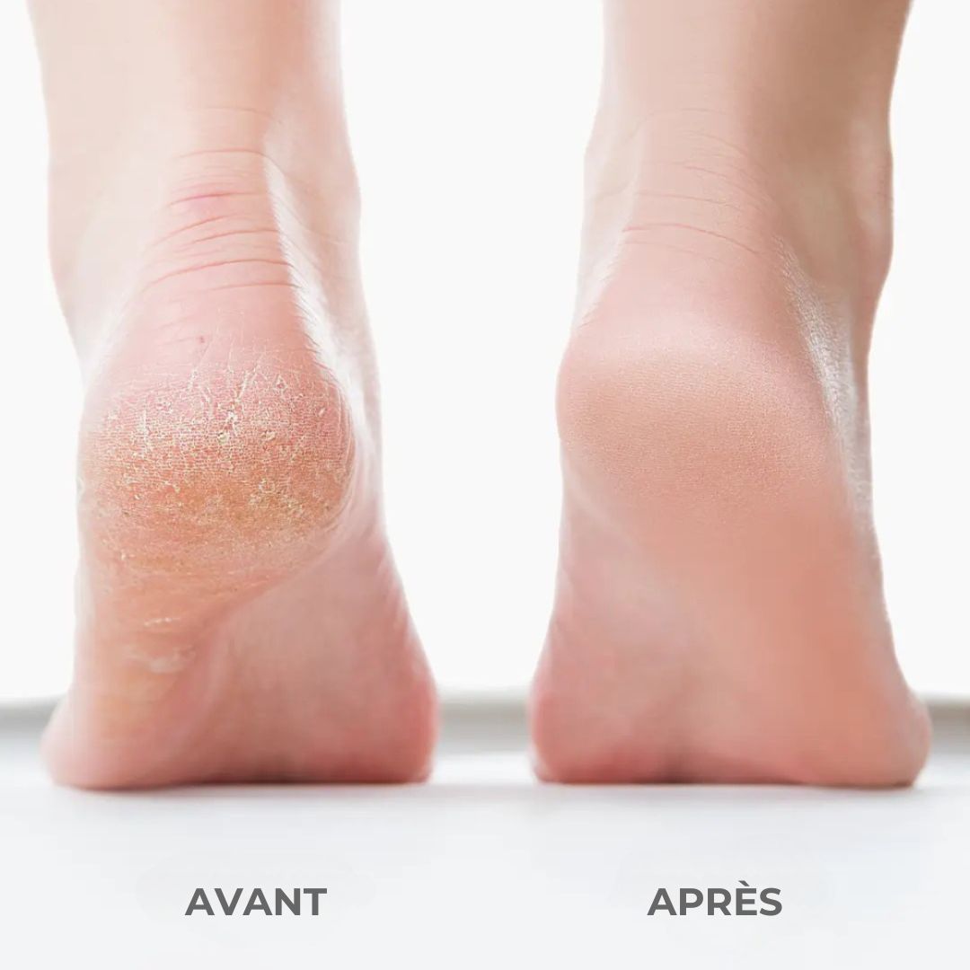 SilkPro– Pieds doux et légers en quelques minutes