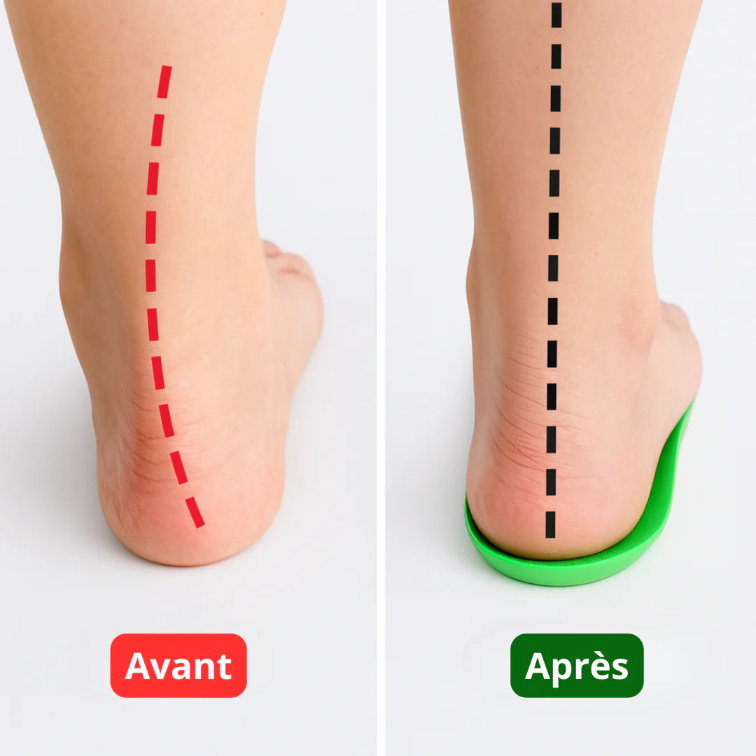 OrthoComfort – Semelles de soutien plantaire pour un confort quotidien
