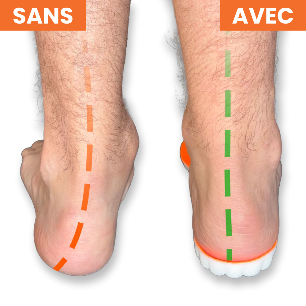 Semelles Orthopédiques - Marchez sans douleur, vivez pleinement