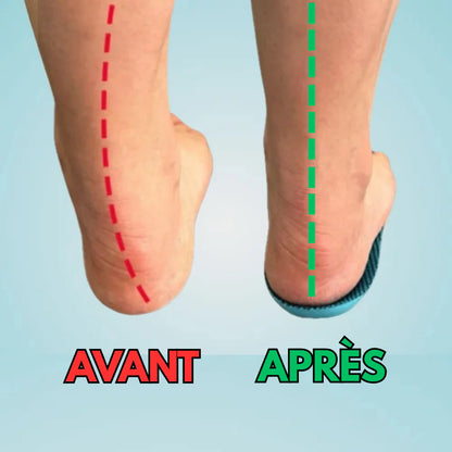 Semelles Orthopédiques Confort+ – Soulagez vos pieds et marchez sans douleur