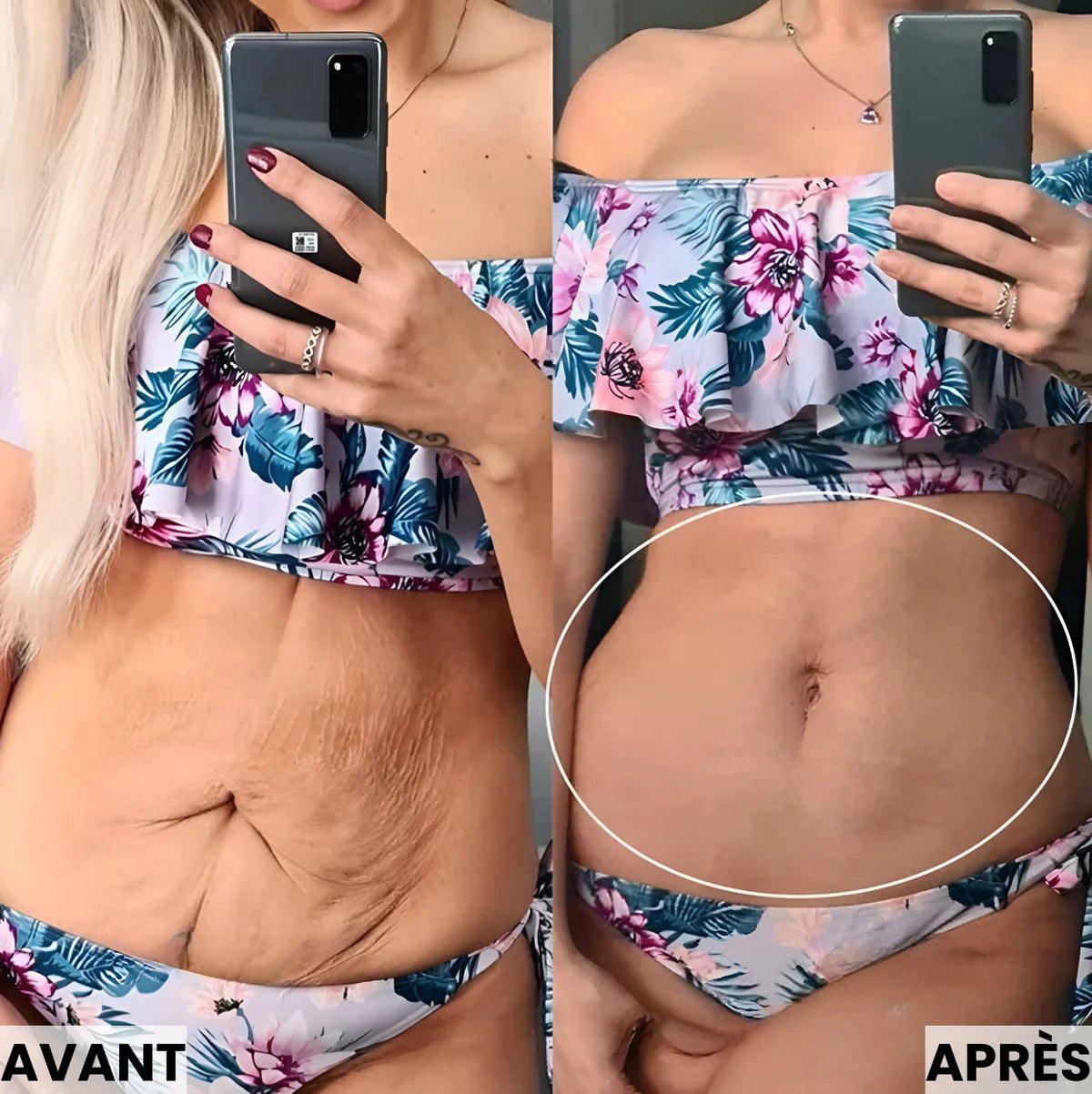 Ceinture Lumière Rouge – Raffermissez, tonifiez et retrouvez confiance