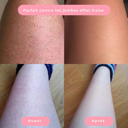 Épilateur LisseSkin – Douceur instantanée, sans douleur
